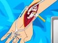 Peli Arm surgery 2