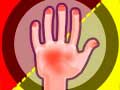 Peli Hands Attack